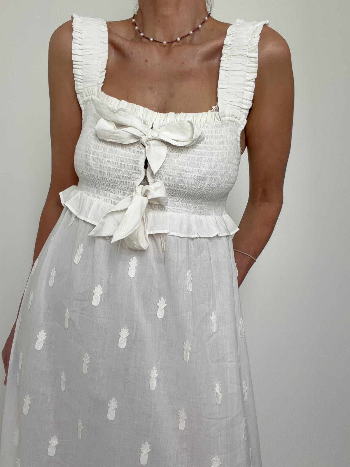 Farm Rio Pineapple Dress